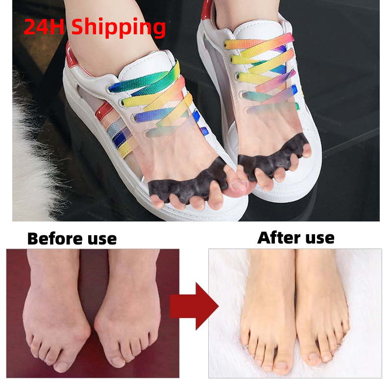 40Pairs Silicone Toe Spacers f – обзор и цена Yoga Toe Separator